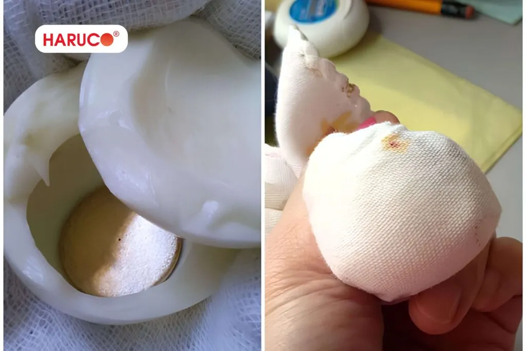 Sau khi cạo gió bằng trứng gà, cơ thể có những thay đổi gì?