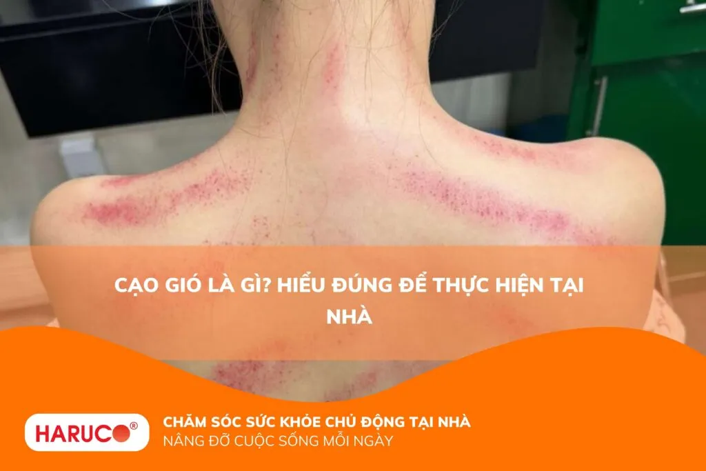 Cạo gió là gì? Hiểu đúng để thực hiện tại nhà
