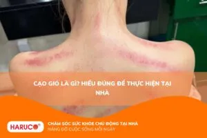 Cạo gió là gì? Hiểu đúng để thực hiện tại nhà