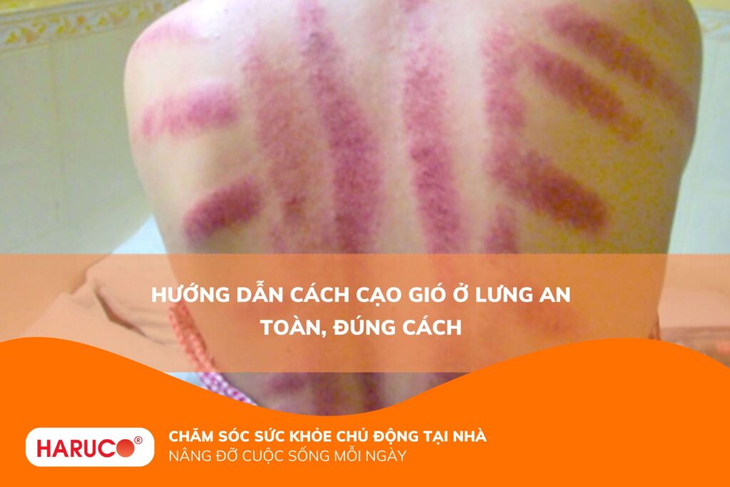 Hướng dẫn cách cạo gió ở lưng an toàn, đúng cách