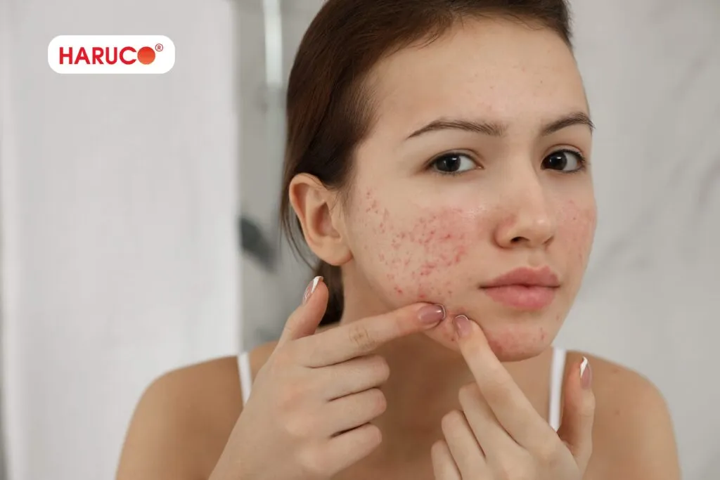 Những điều không nên làm sau khi xông mặt